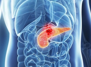 Ung thư tuyến tụy “đáng sợ” như thế nào?